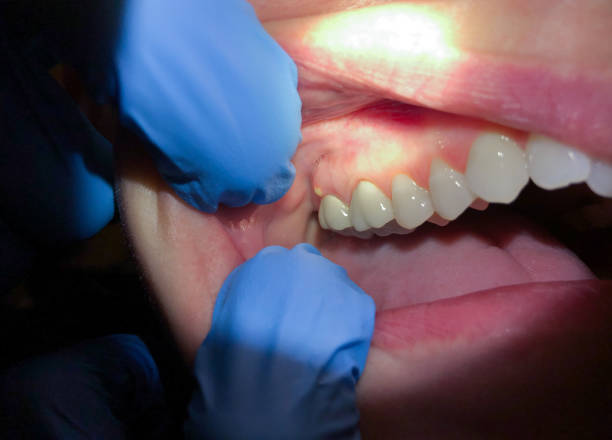 Best Same-Day Emergency Dentist in England, AR