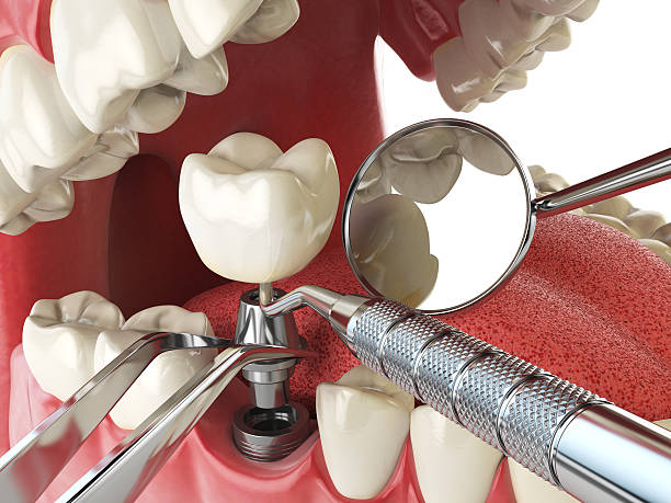 Best Walk-In Emergency Dentist in England, AR